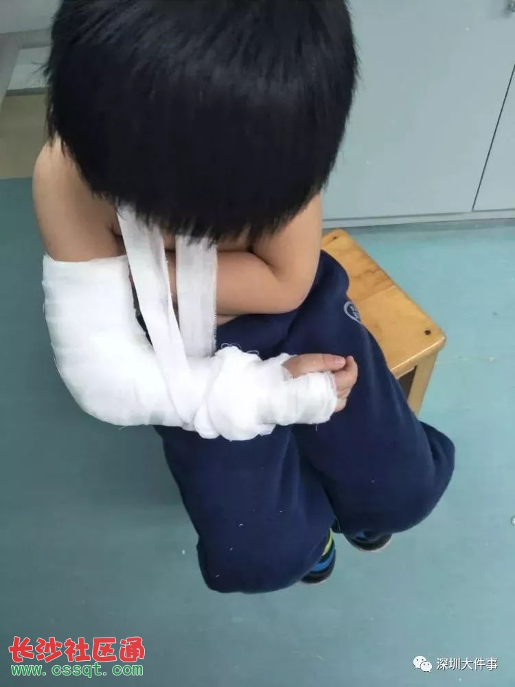 深圳5岁男童幼儿园午睡时骨折 家长指老师虐待 真实情况究竟如何?