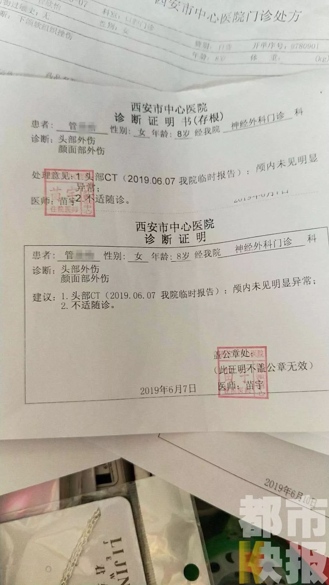 遛狗不拴绳!西安一女童公园内受惊吓 失足摔成脑震荡