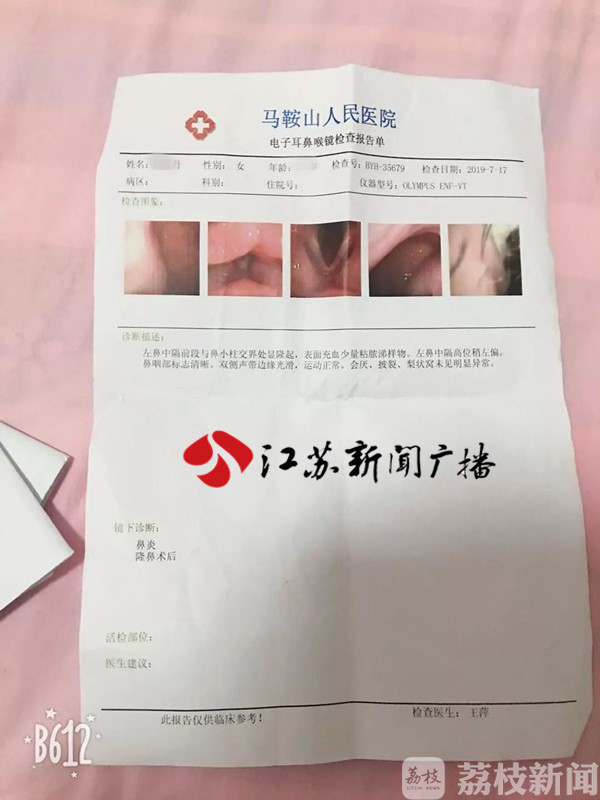 女子隆鼻十多天后 鼻腔里竟残留一节长纱布