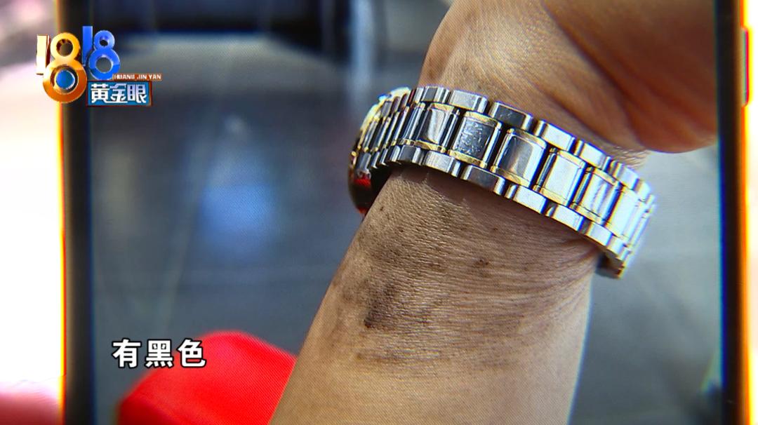 一万多买的手表 戴着手腕会发黑?
